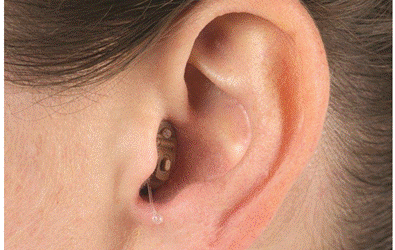 Which hearing aids are right for you?